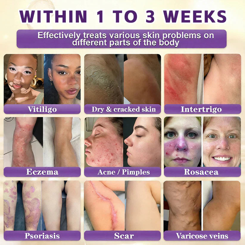 Windolix® Biotin 10-in-1 Skin Restoration Cream