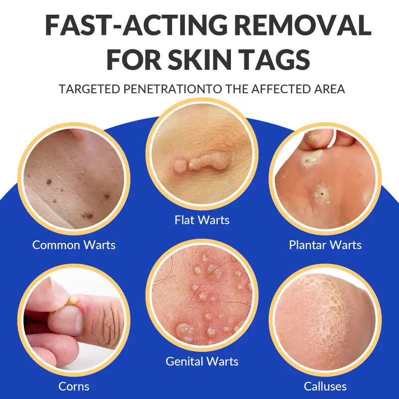 Dr.Ramay WART REMOVER GEL